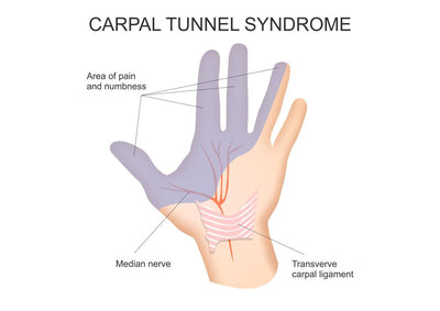 Training with Carpal Tunnel